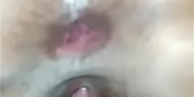 anal,ass